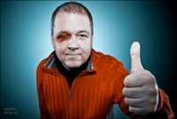 сыпь на коже члена